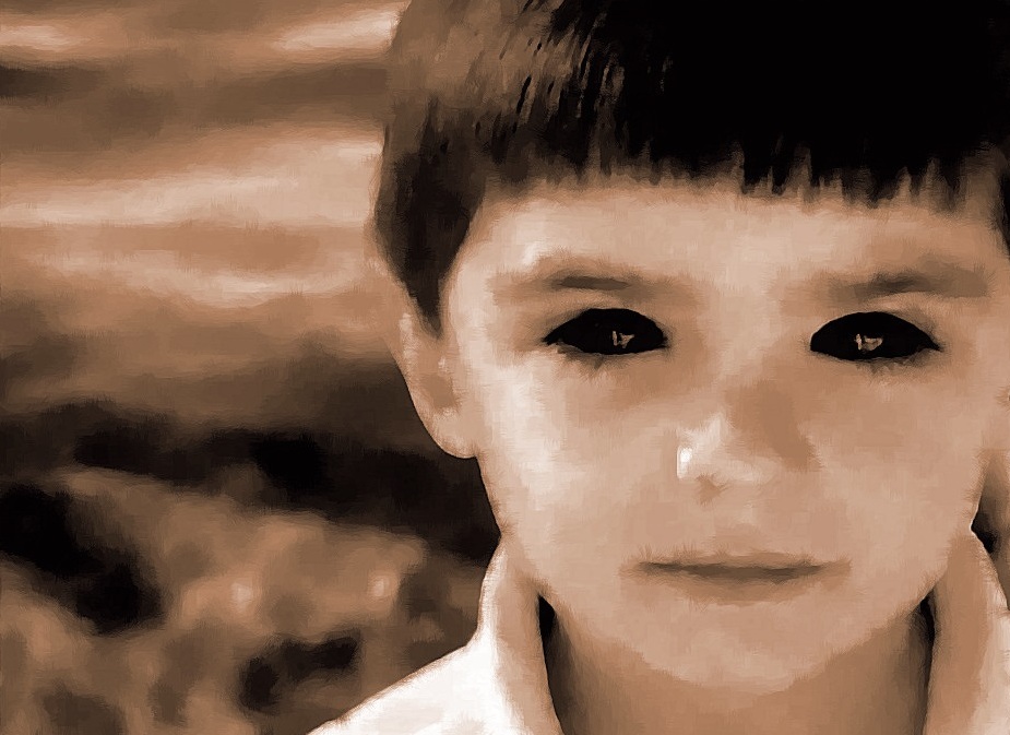 black eyes